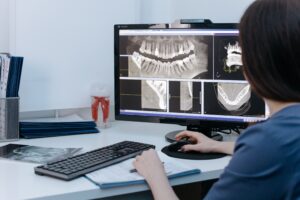 3D-рентген зубов